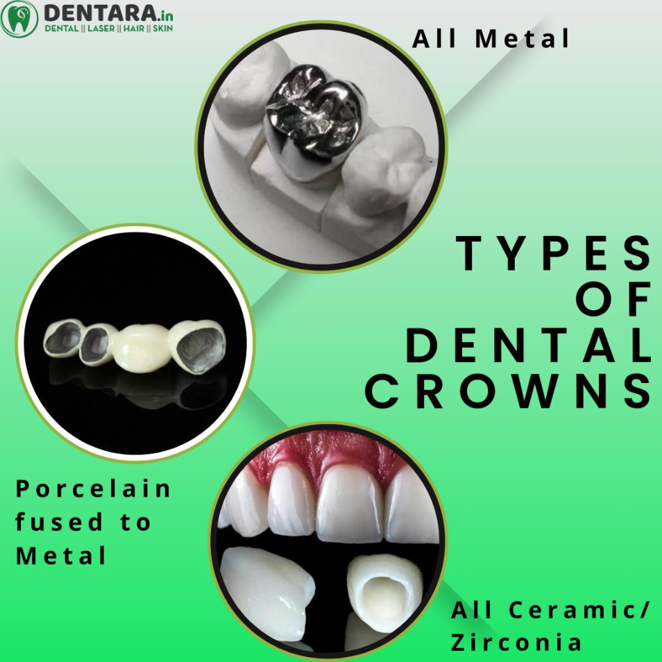 dentara portfolio image